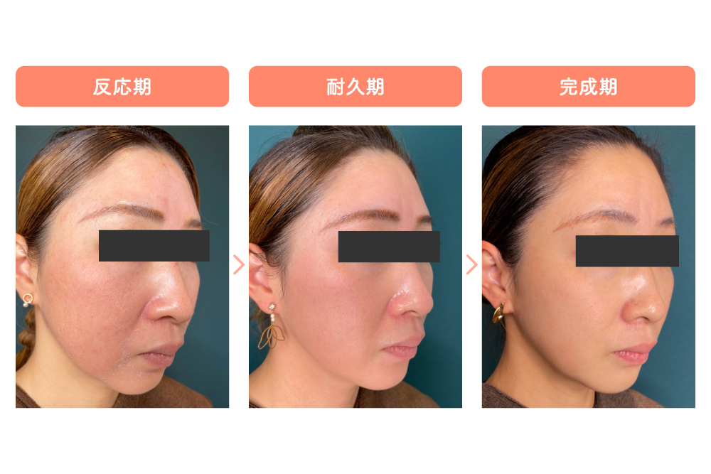 e382bce382aae382b9e382ade383b3e5a4b1e69597e4be8befbc9ae8828ce38388e383a9e38396e383abe38292e981bfe38191e3828be3819fe38281e381aee5ae9f