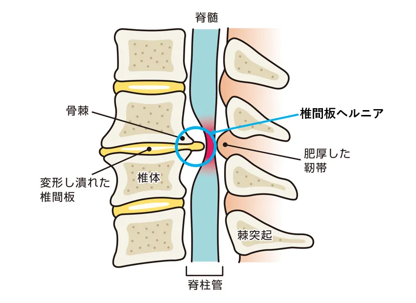 e38398e383abe3838be382a2e6898be8a193e5a4b1e69597e381aee5ae9fe4be8be381a8e58e9fe59ba0e38292e5beb9e5ba95e8a7a3e8aaac